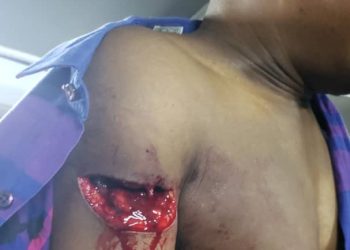 Urgent en Ituri : Le journaliste Serge Karba a été blessé par des bandits à Bunia !